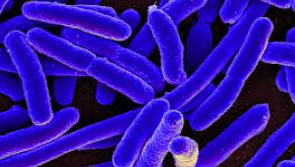 Suspected case of E coli infection reported to parents of children in a Laois creche