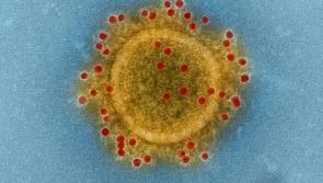 Dublin Midlands Hospital Group issues statement on Coronavirus Covid-19