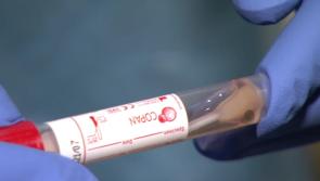  Covid-19 patient numbers in ICU continue to fall along with welcome hospital figures 