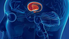 DR EDDIE MURPHY: The heartbreak of rare Huntington's Disease