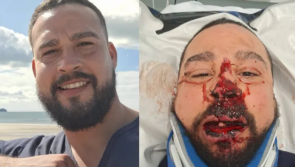 Community rallies to help badly injured student who got hit by a car during Storm Jocelyn