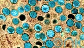 Vaccination advice for groups most at risk of monkeypox to be issued soon
