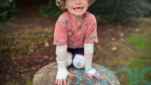 Book about ‘warrior’ four-year-old helps classmates understand skin condition