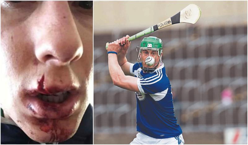 Laois hurling captain awarded Joe McDonagh Champion 15 GAA award