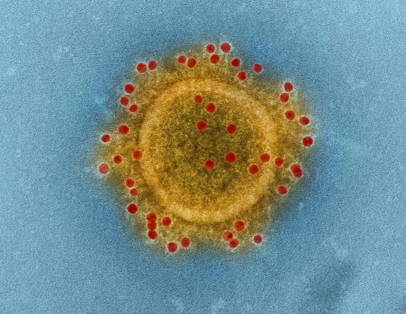 Outbreak of Covid-19 at large Dundalk company