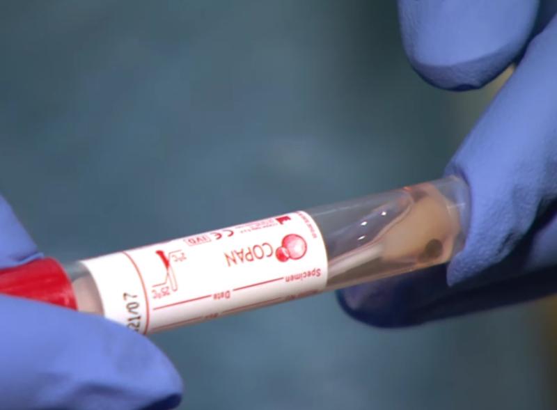 Concern grows as Louth Covid-19 incidence rate rises