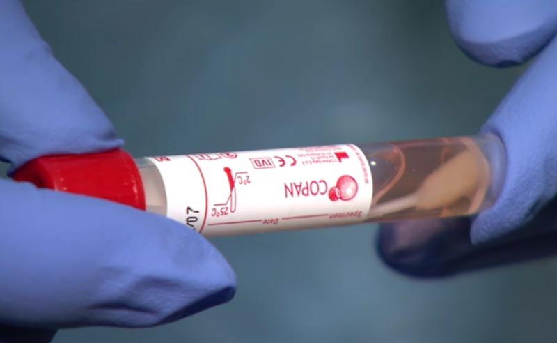 coronavirus covid-19