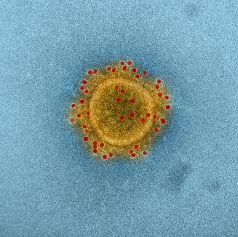 coronavirus covid-19