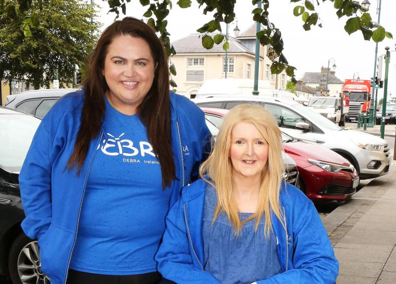 Influencer inspired by Laois woman from raises €100,000 for skin condition charity
