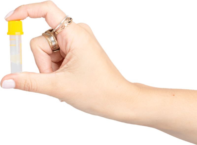 Home  STI testing service has been extended to Leitrim, Sligo and Donegal