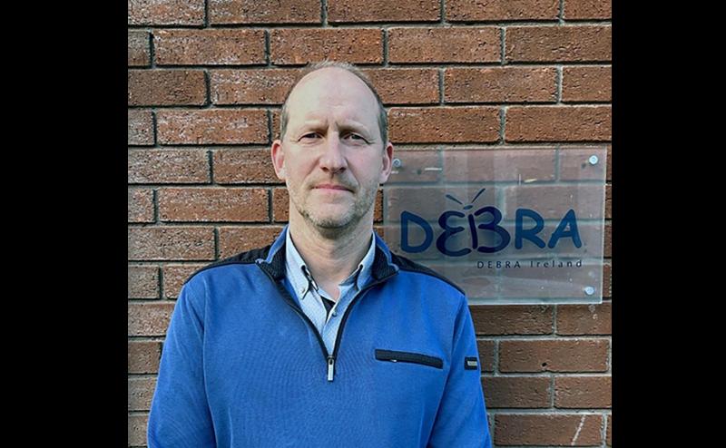 Gel therapy to treat ‘butterfly skin’ condition welcomed by Irish charity