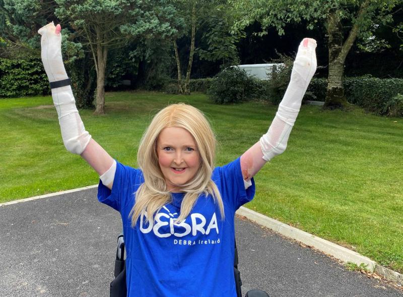 Laois hero Emma launches StepTember fundraiser for Debra Ireland