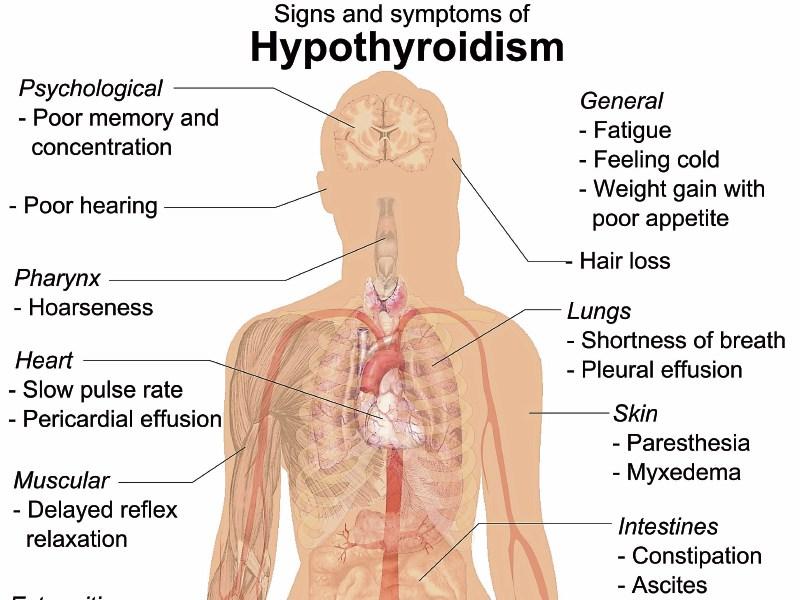 Healthy Living: Dealing with hypothyroidism