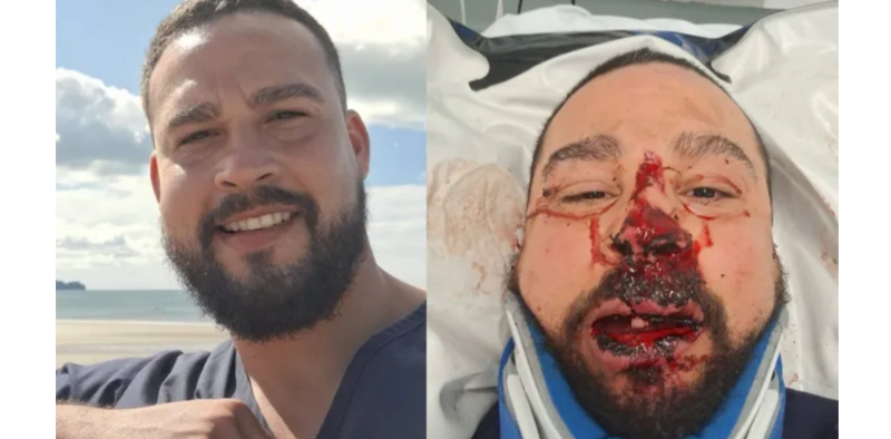 Community rallies to help badly injured student who got hit by a car during Storm Jocelyn