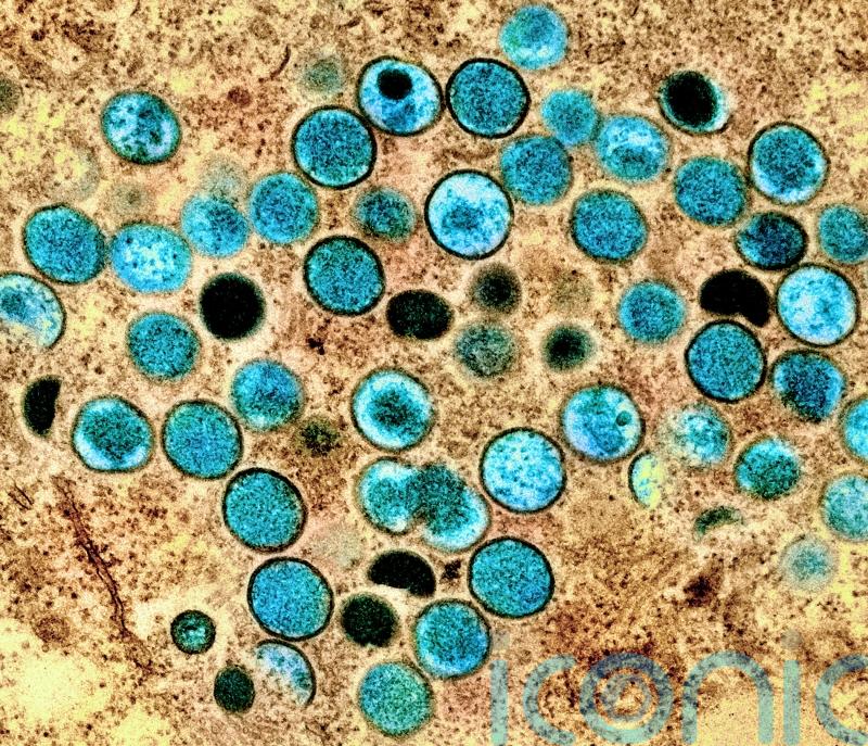 Vaccination advice for groups most at risk of monkeypox to be issued soon